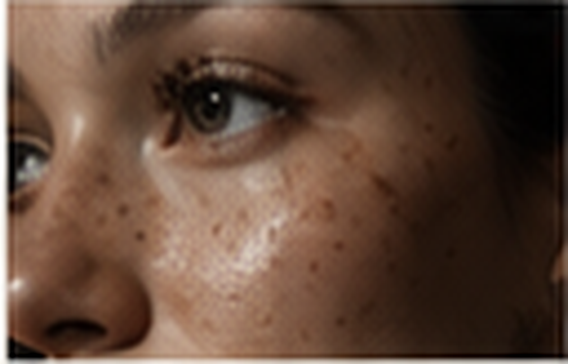 Close-up of a person's face showing eye, nose, and cheek with freckles.