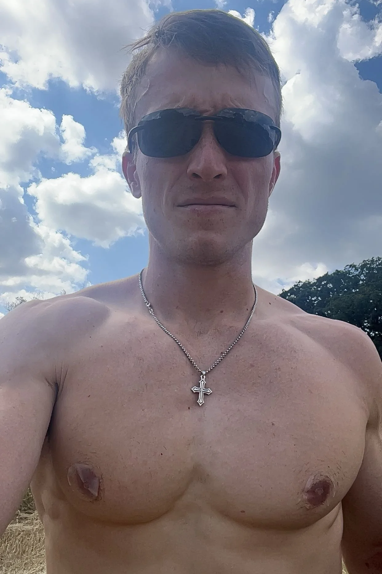 Bloody Nipples &amp; Blisters