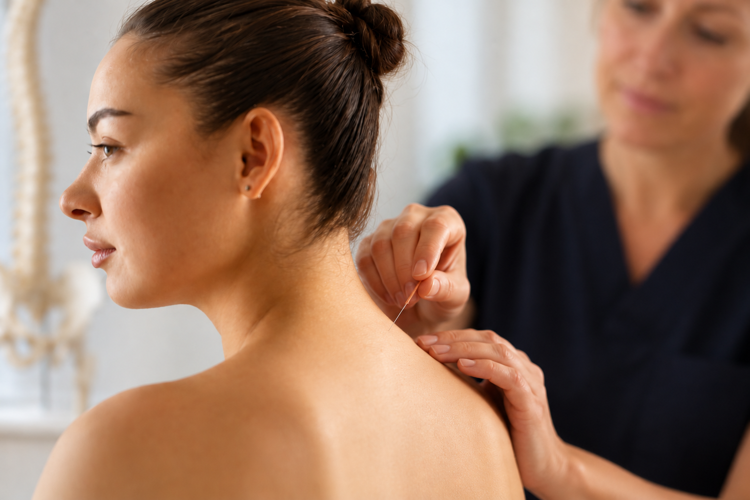 A woman receiving acupuncture treatment on her shoulder from a practitioner in a treatment room.