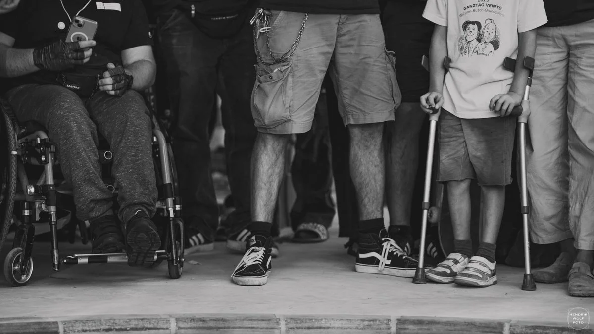 Black and white photo of people standing closely together, including a person in a wheelchair, a child with crutches, and several adults, with only their legs and feet visible.