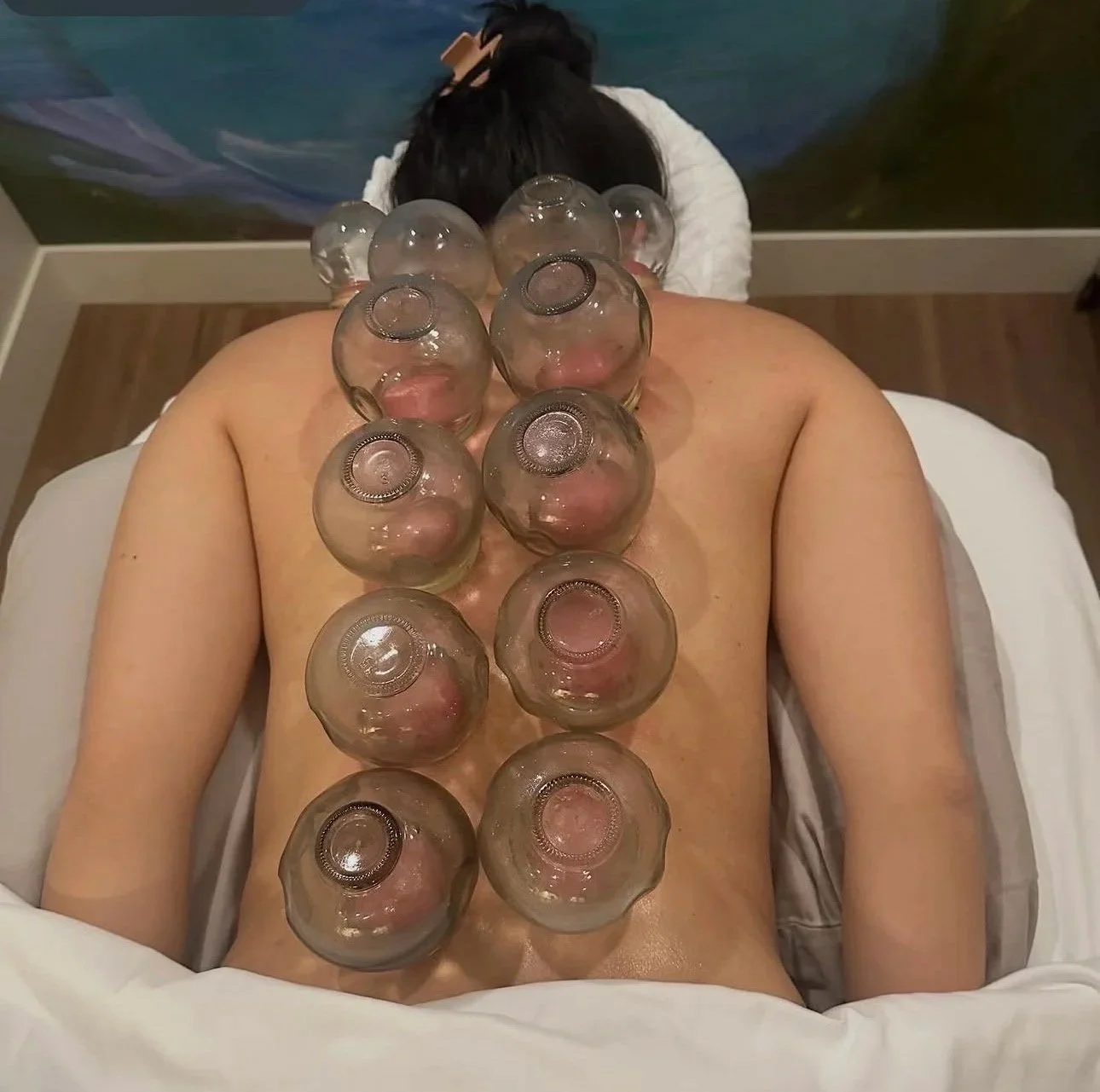 massage with cupping with Elizabeth Hardy