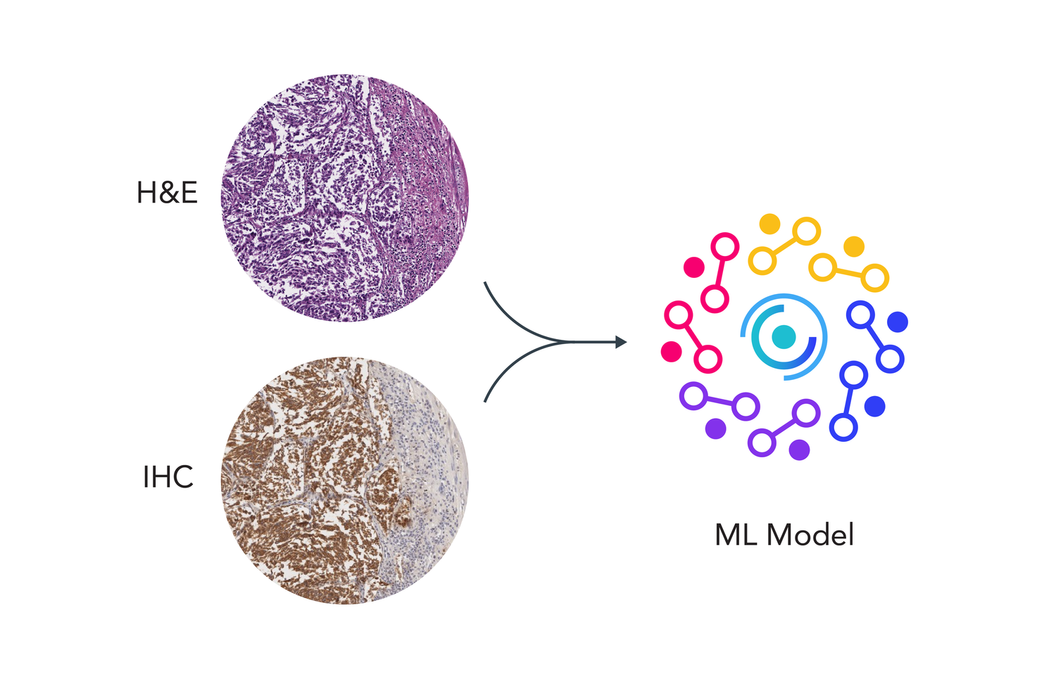 Training: paired H&E and IHC images feed the ML model