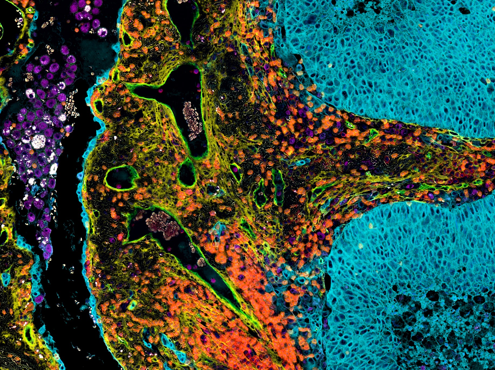 Virtual multiplex immunofluorescence close-up with per-cell expression