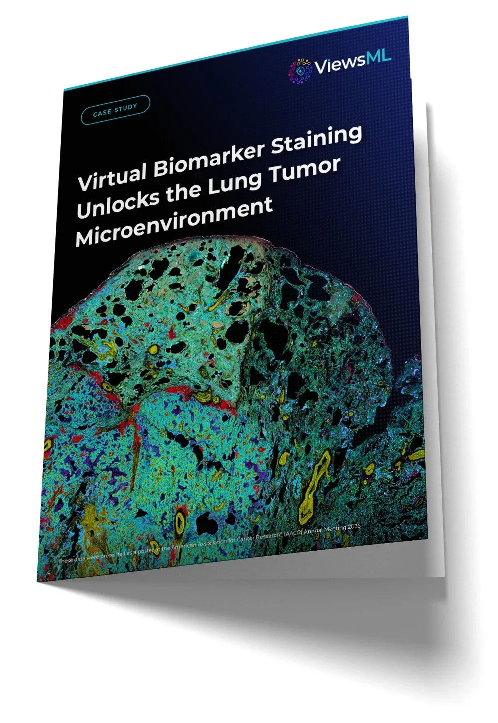 ViewsML-Case-Study-Lung-Tumor-Microenvironment.webp
