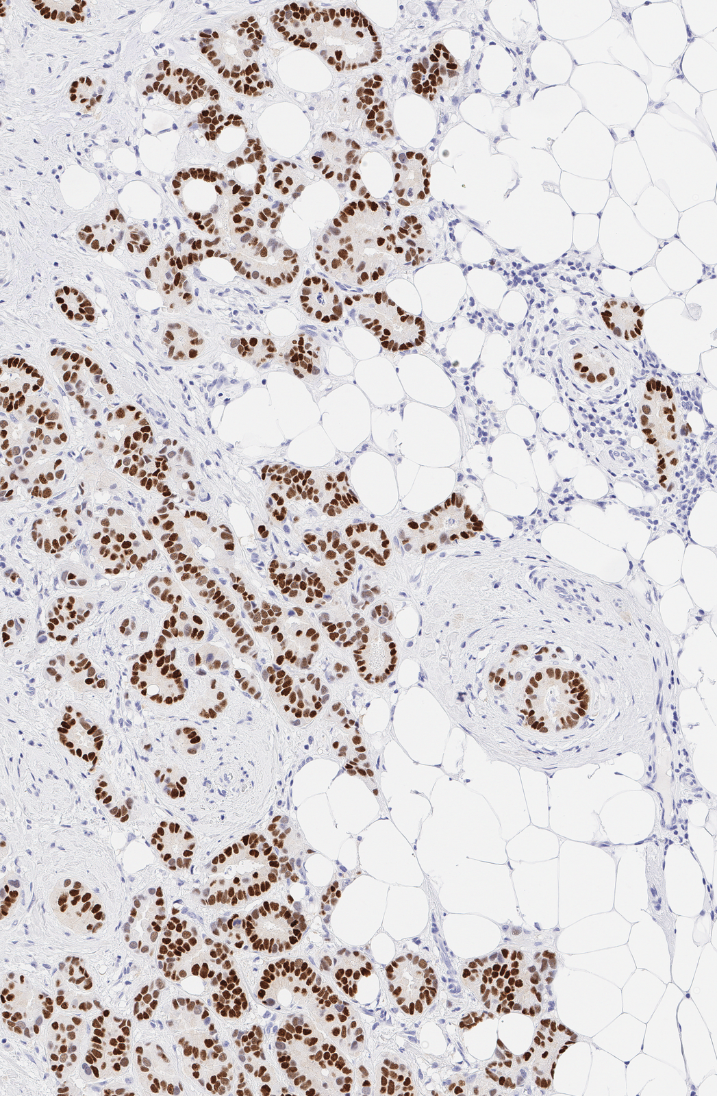 Physical IHC detail