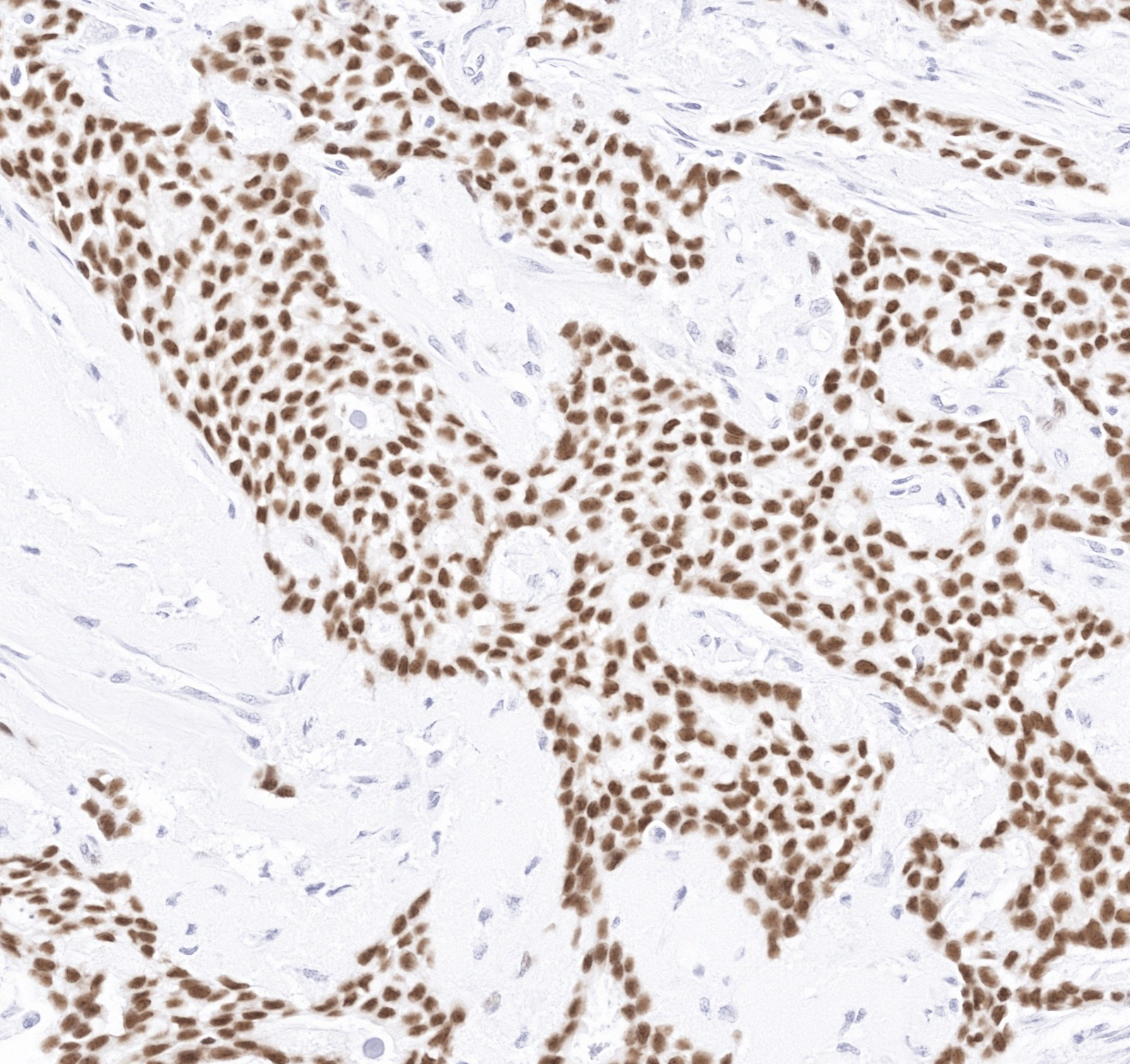 Virtual IHC output
