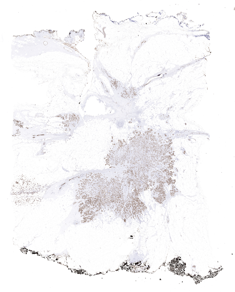 Virtual IHC whole slide