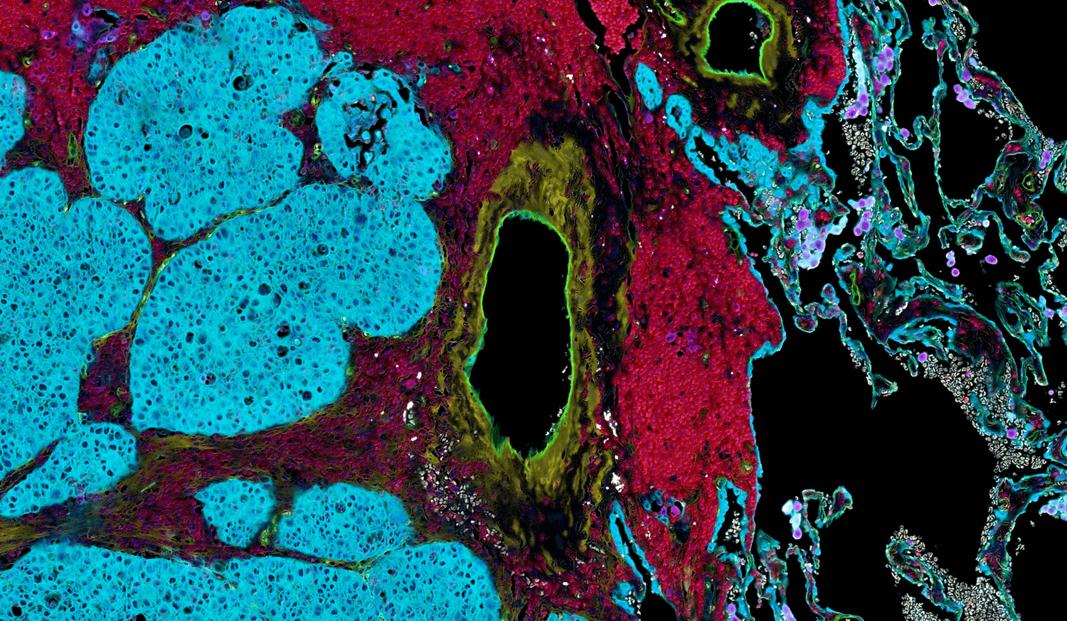 Virtual immunofluorescence