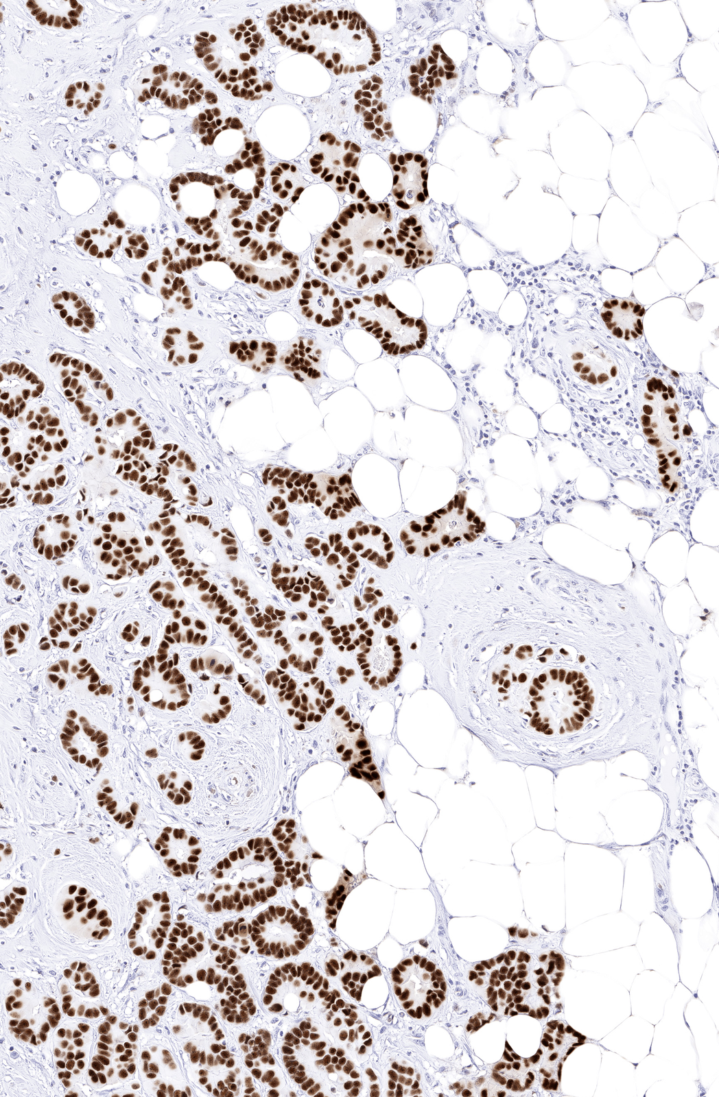 Virtual IHC detail
