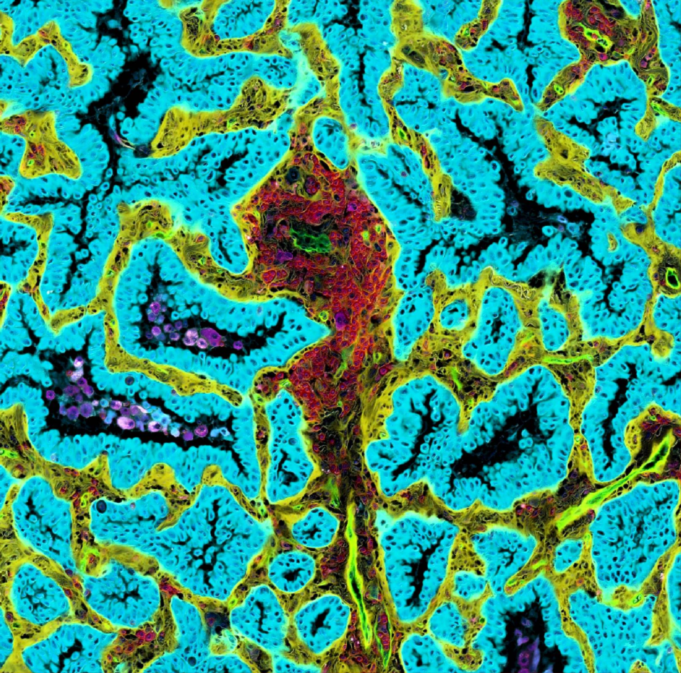 Virtual multiplex immunofluorescence