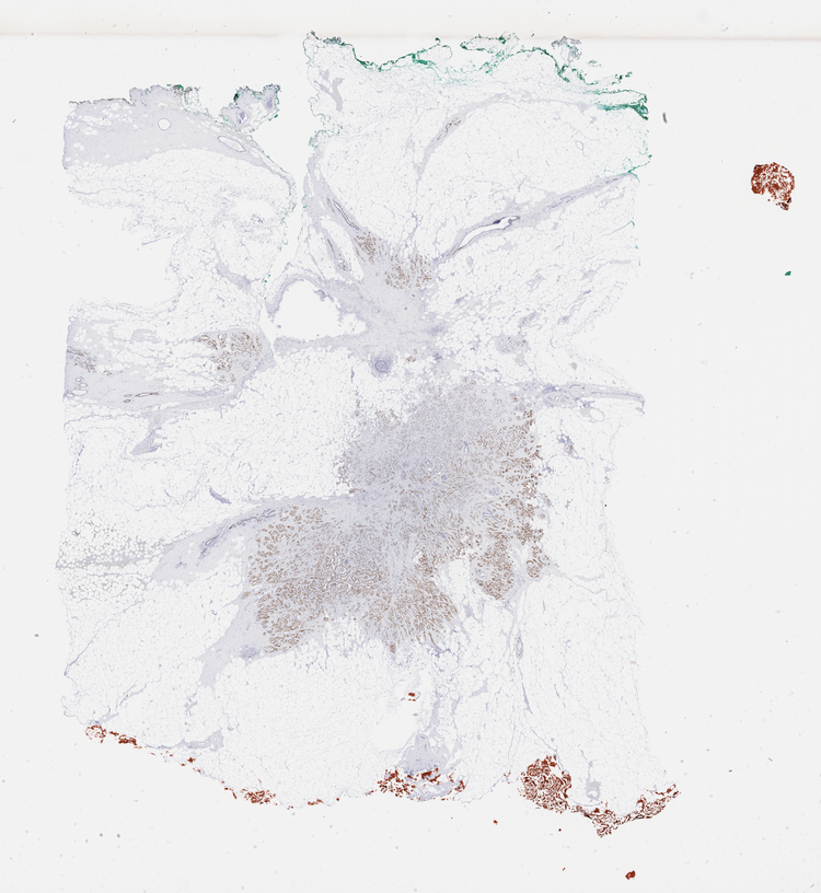 Physical IHC whole slide