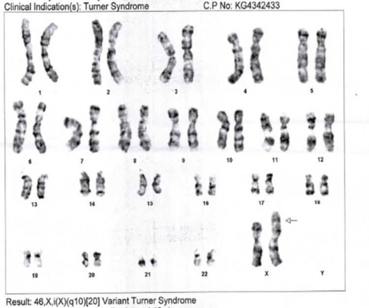 Chromosomes