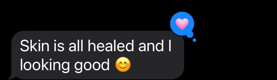 A screenshot of a message bubble saying "Skin is all healed and I looking good" with a smiling emoji, and a small blue thought bubble with a pink heart inside.