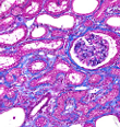 Animal Models of Kidney Disease