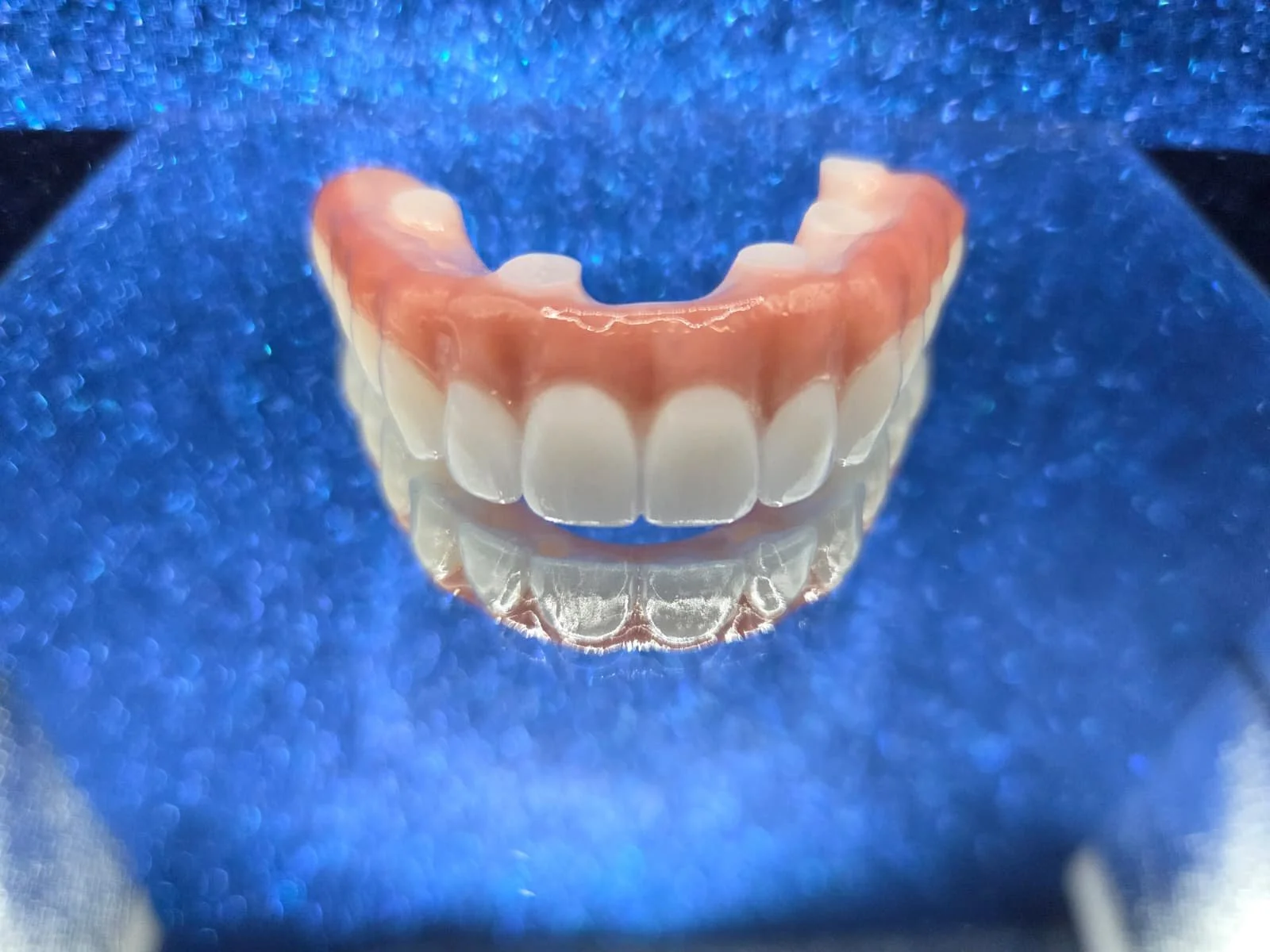3D printed temp, Pmma milled arch, Zirconia arch