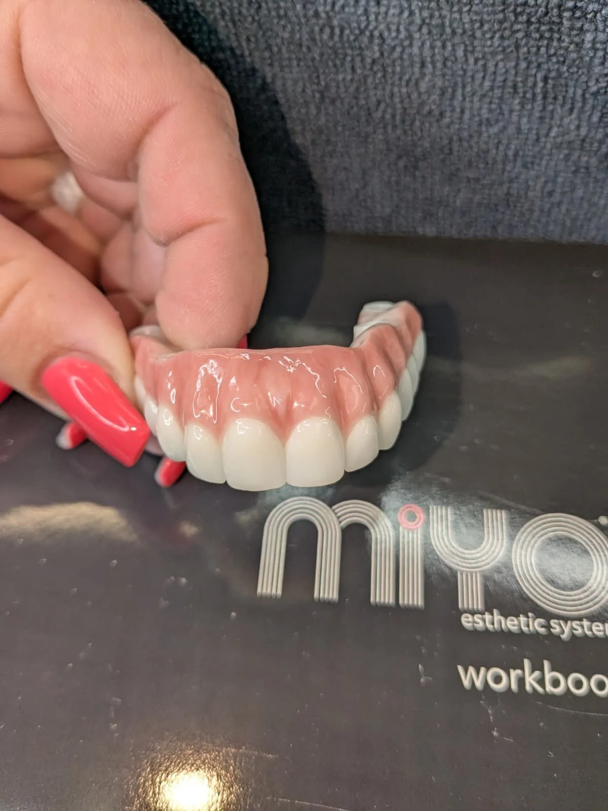Jensen, Miyo, Zirconia full arch, Printed 3d try-in and long term temps