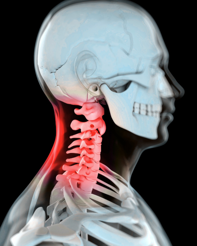 Medical illustration of a side view of a human head and neck, highlighting the cervical spine in red, with the skull and upper chest visible.