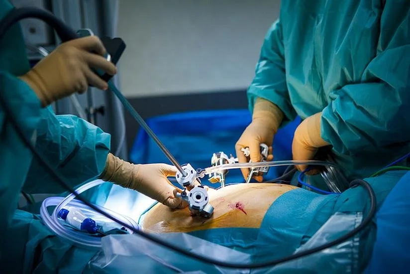 Why did my Hernia Come Back?