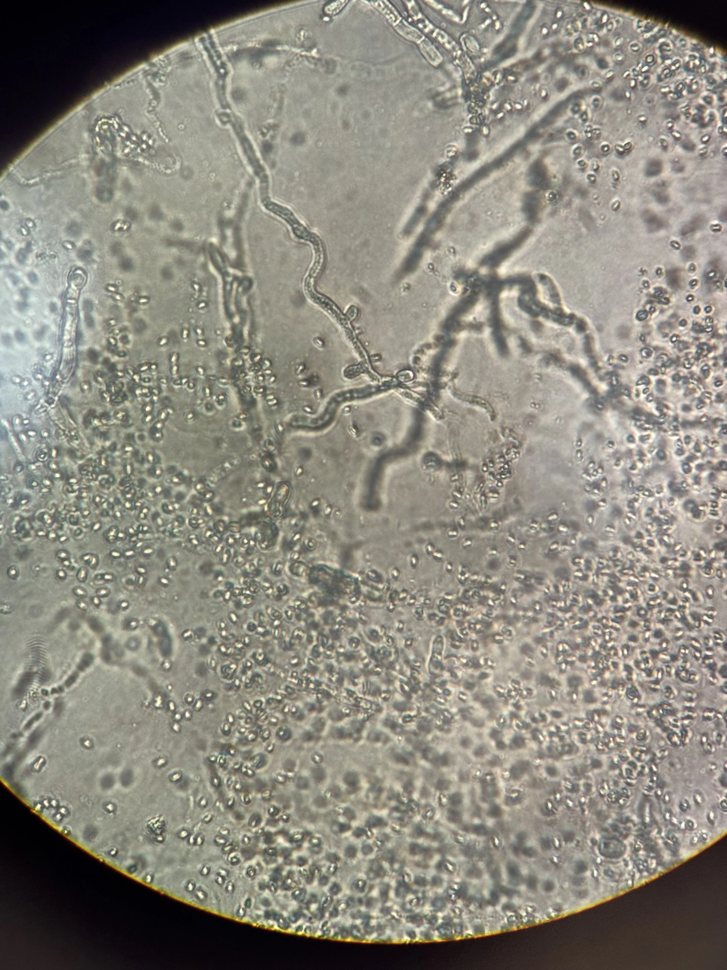 Microscopic view of numerous small, spherical cells and elongated thread-like structures inside a circular frame.
