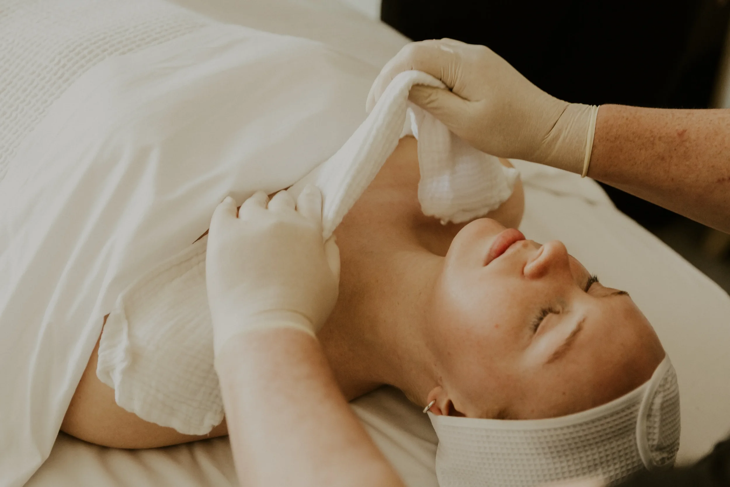 Ultraceuticals Azyme Peel