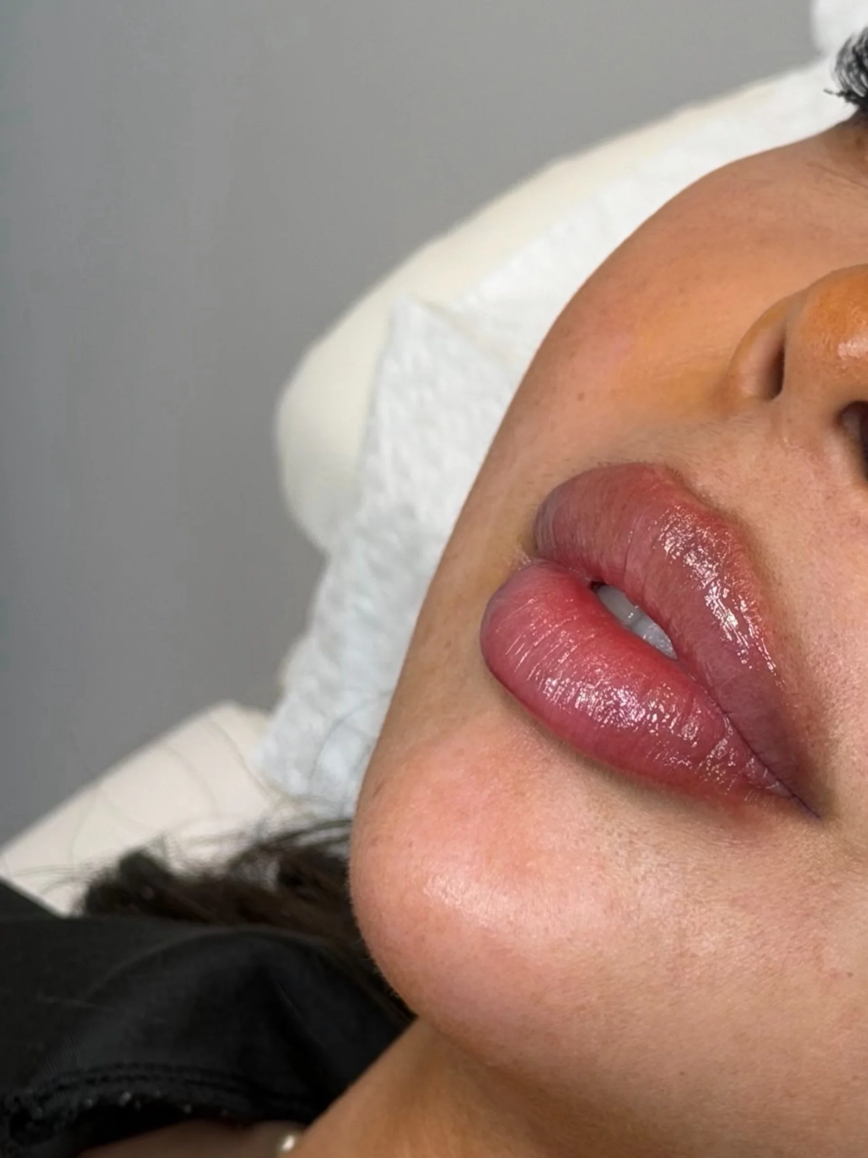 Close-up of a woman's face including her lips and part of her eye, with skin showing freckles and smooth texture.