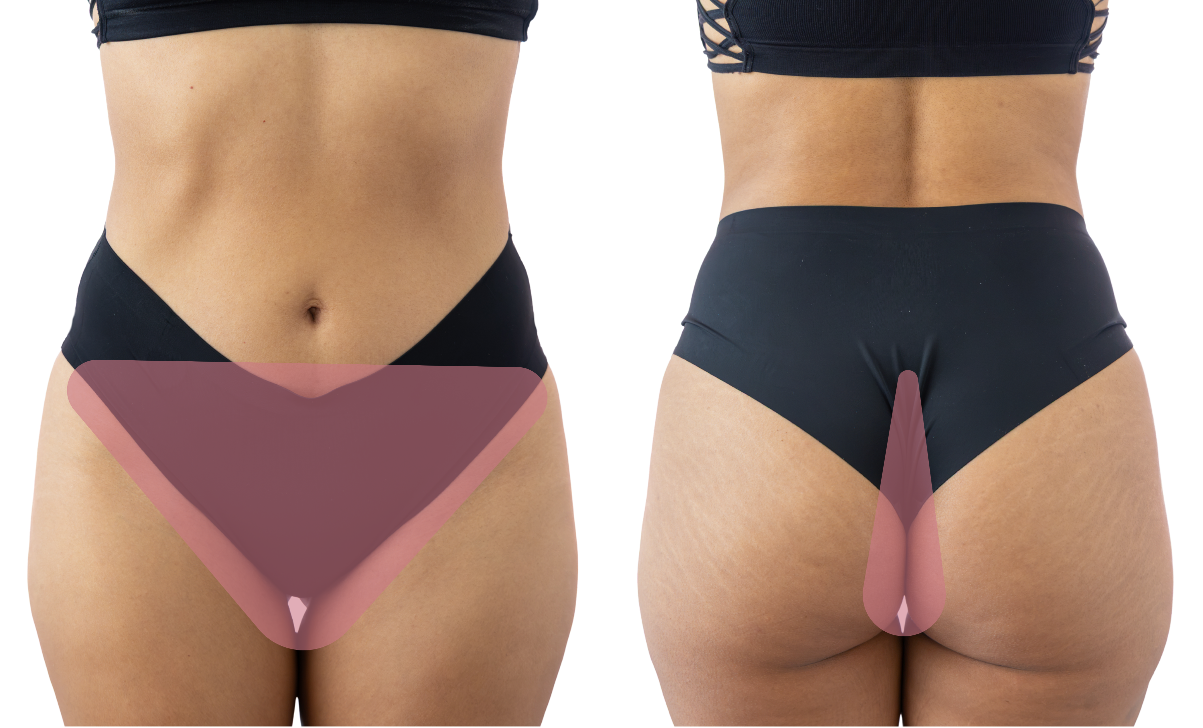 Diagram of woman's midsection, front and back, showing the hair removal section for the "Brazilian" wax.