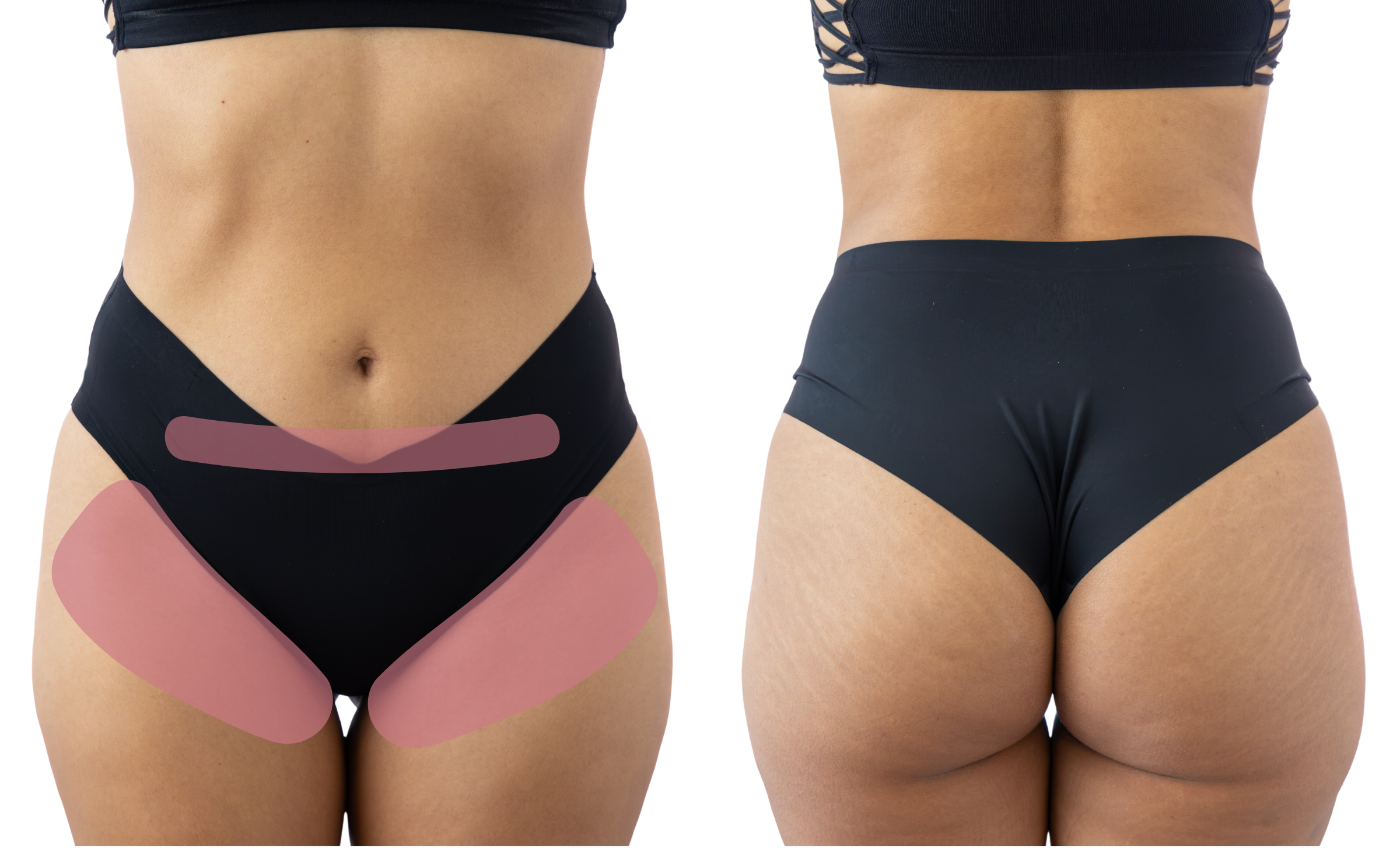 Diagram of woman's midsection, front and back, showing the hair removal section for the "Basic Bikini" wax.
