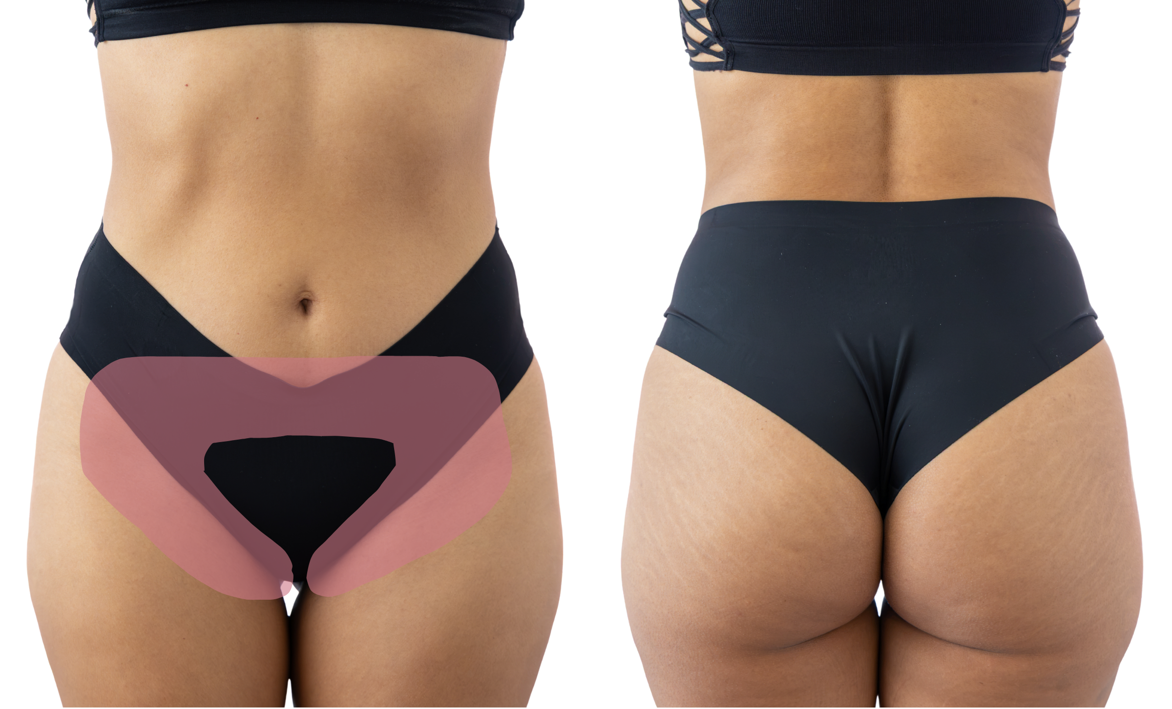 Diagram of woman's midsection, front and back, showing the hair removal section for the "Modified Bikini" wax.