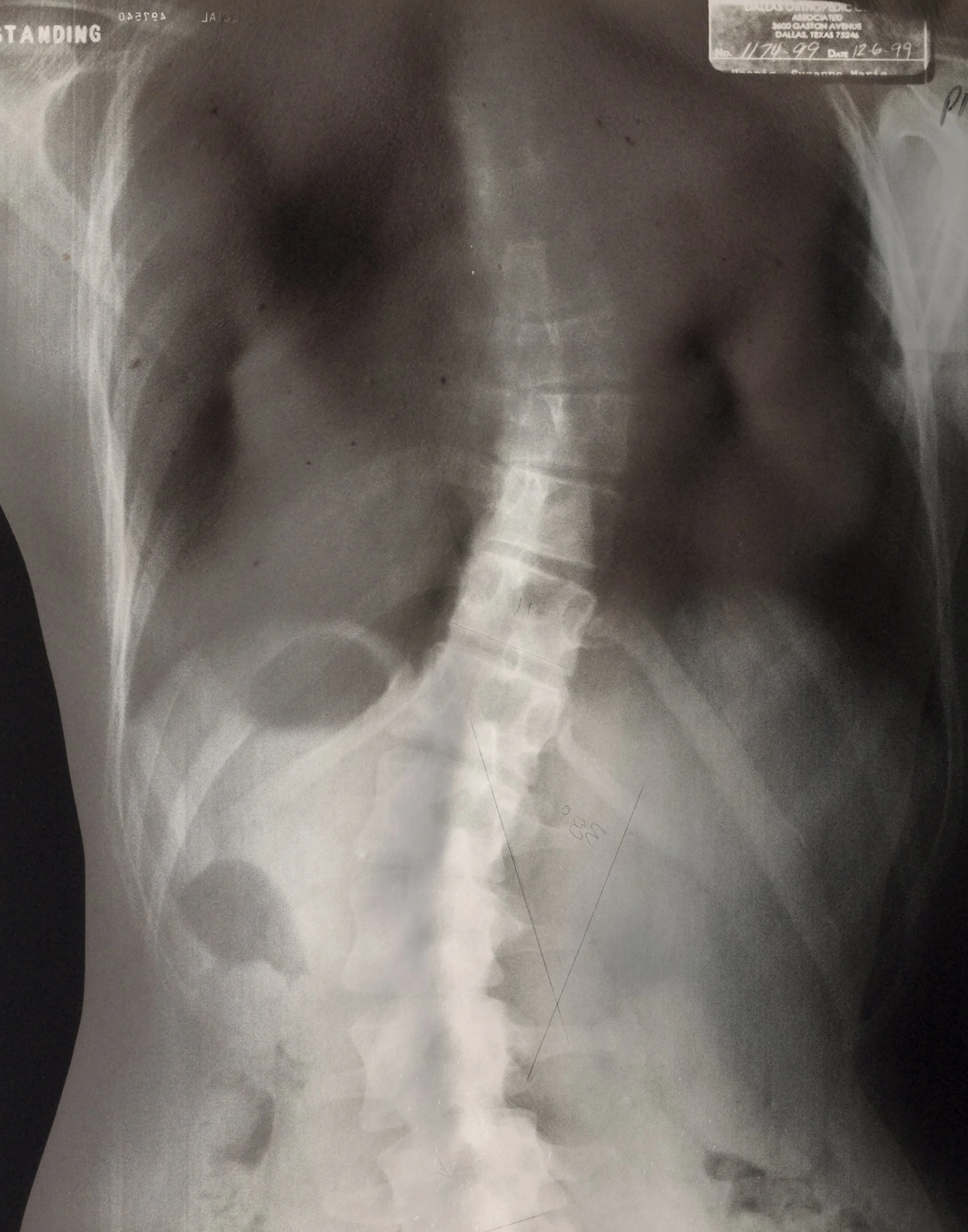 Spine.jpg