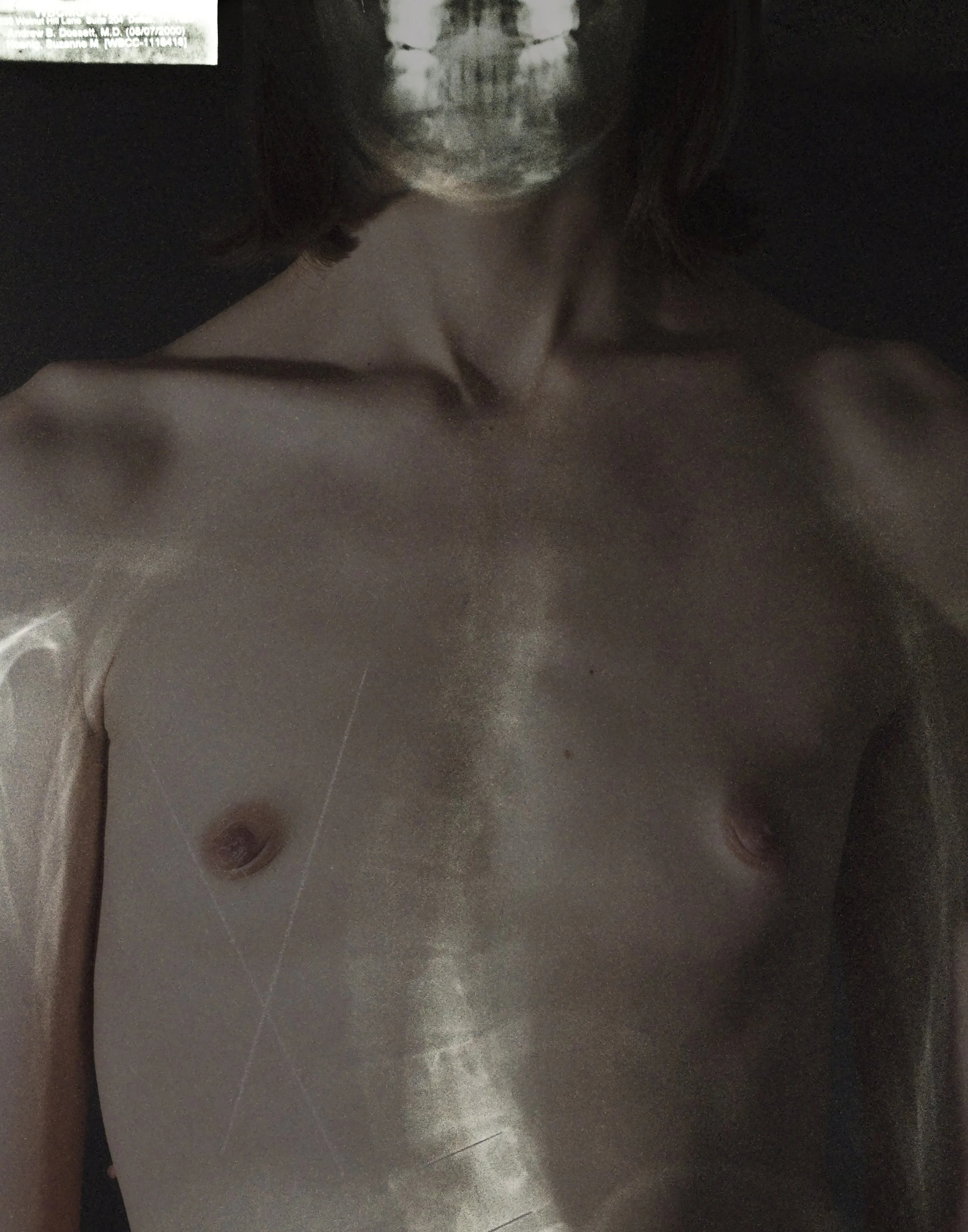 Chest.jpg
