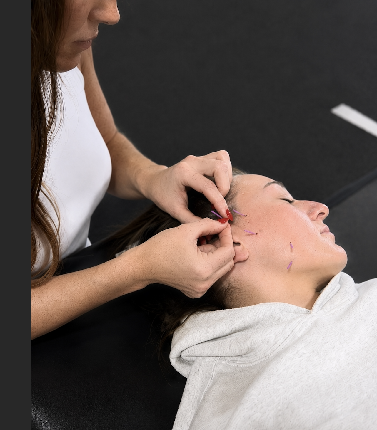 Dry needling for TMJ, jaw pain, and headaches.