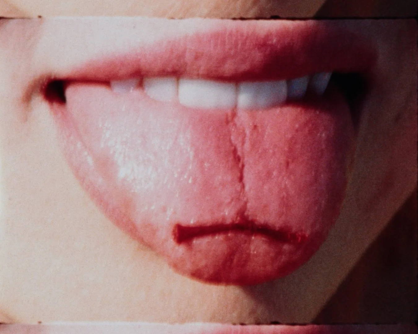 Close-up of a person's mouth with their tongue sticking out, showing a vertical split down the middle of the tongue.
