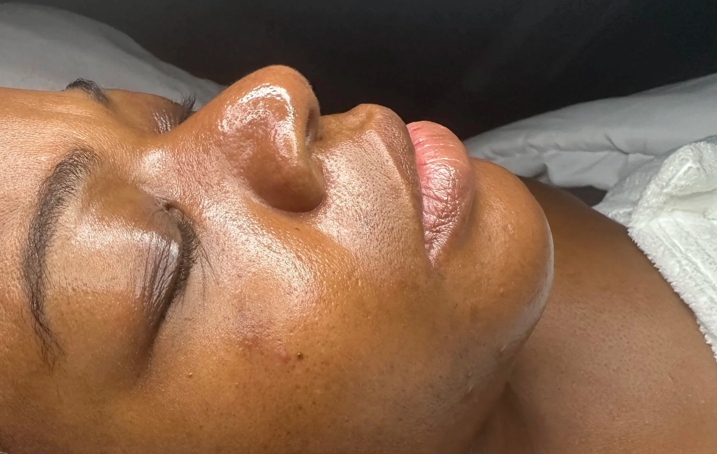 A person receiving a facial treatment, lying down with eyes closed, covered with a white towel.