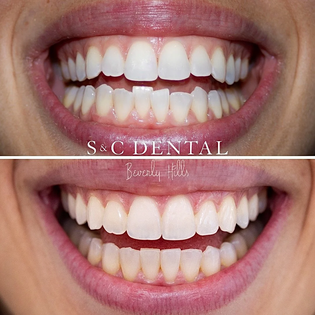 snc-before-after.jpg