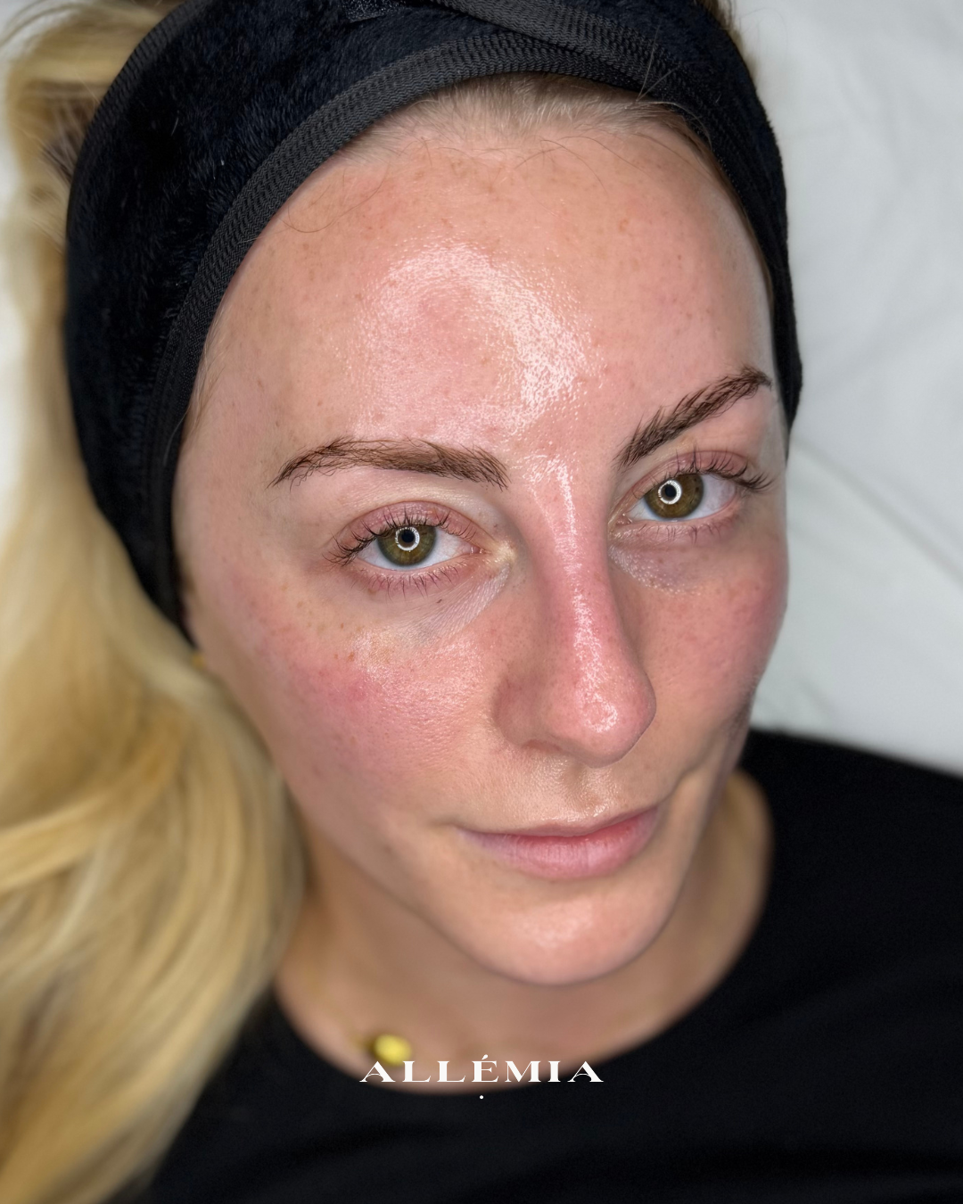 Glass Skin Facial