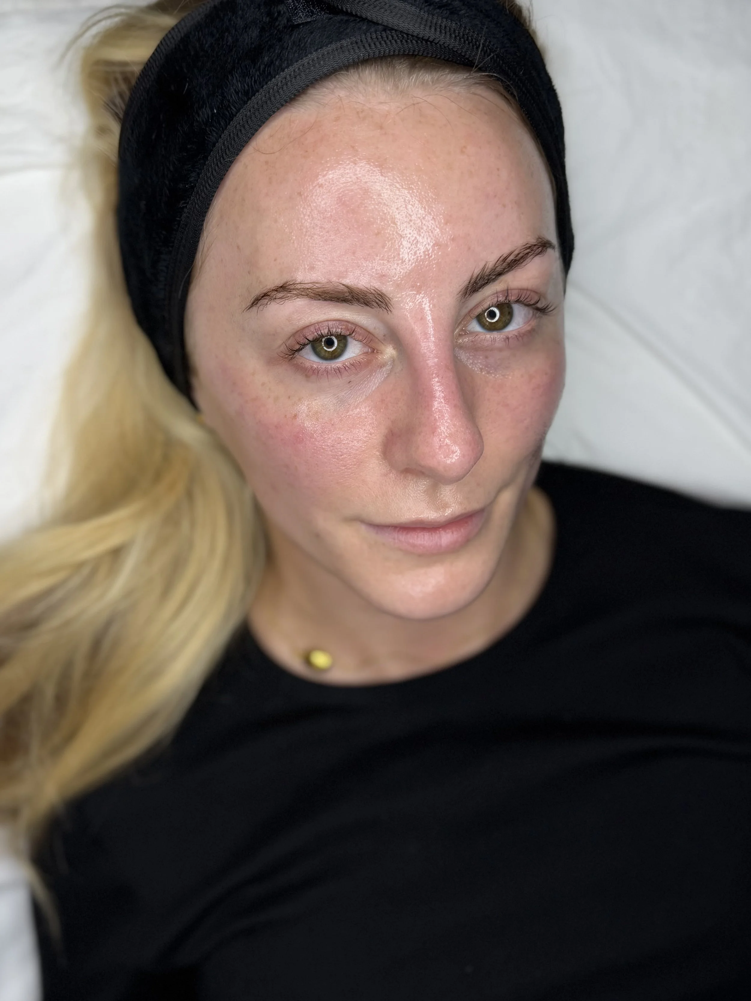 A woman lying down with a headband, showing a clear forehead and face with natural skin and eye makeup, wearing a black top and a small yellow pin.