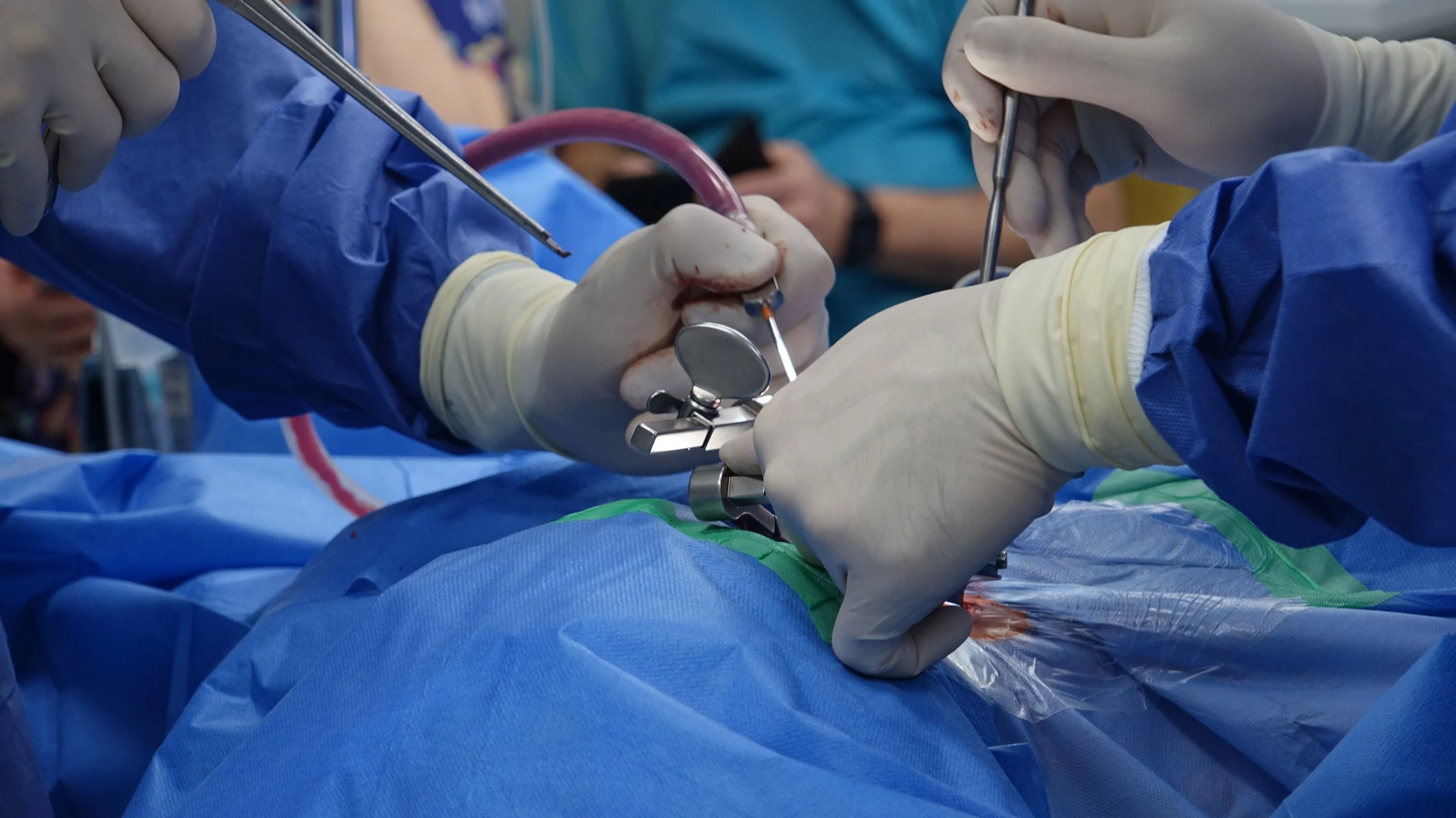 Two weeks hands on laparoscopy