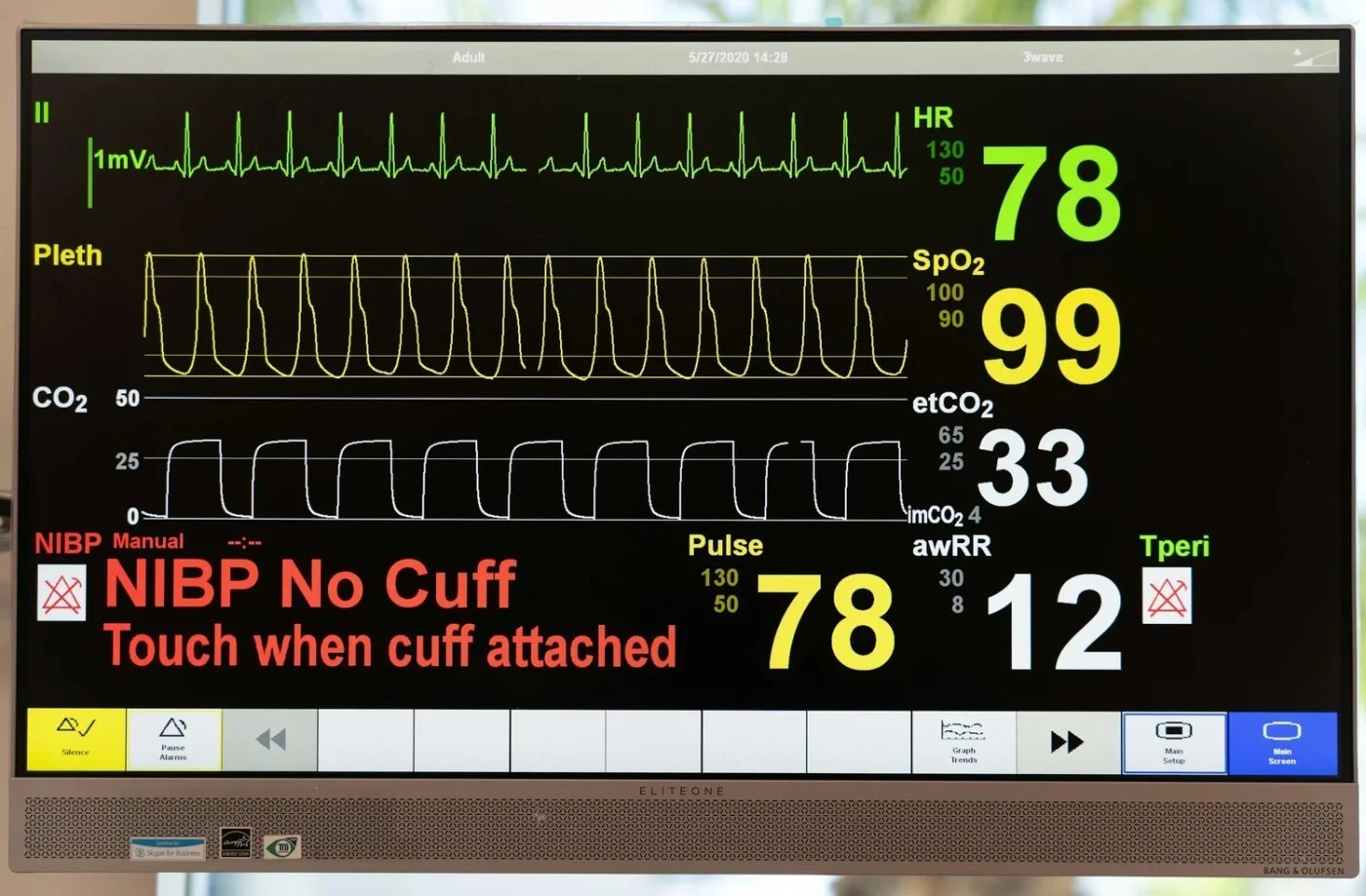 Why More Healthy People Are Getting Advanced Heart Screening