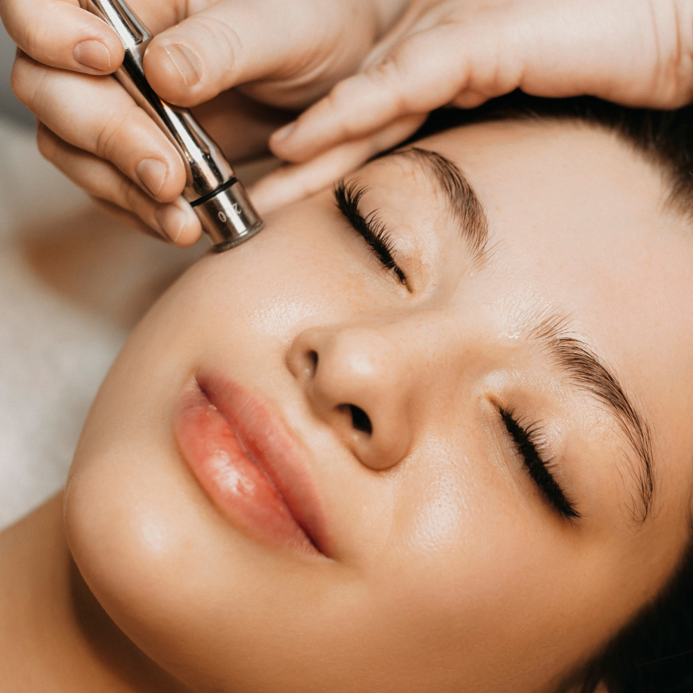 Woman receiving a diamond-tip microdermabrasion treatment to exfoliate dead skin cells and improve skin texture at a skincare studio.