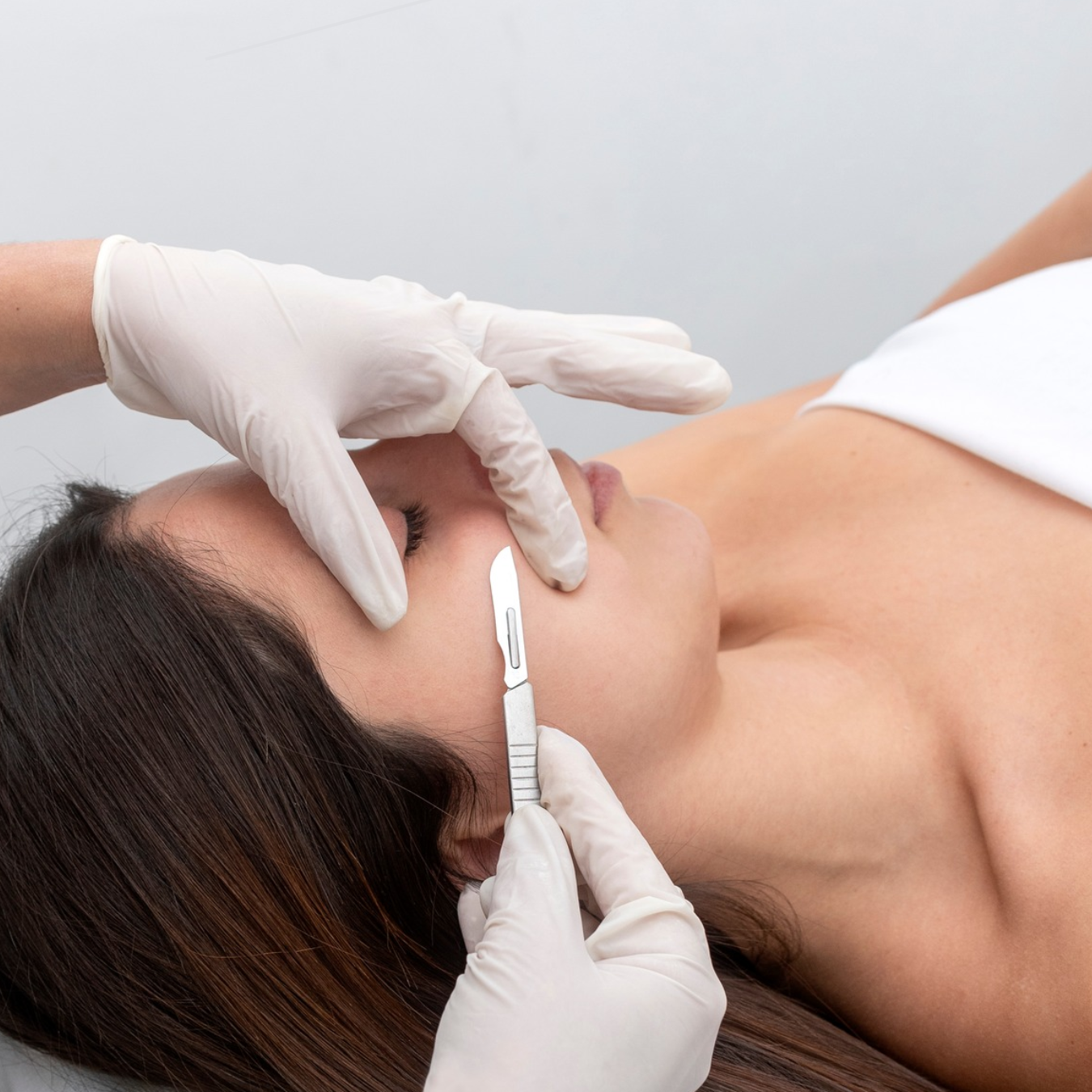 Close-up of a dermaplaning treatment using a specialized blade to gently remove dead skin cells and peach fuzz from a woman's face.