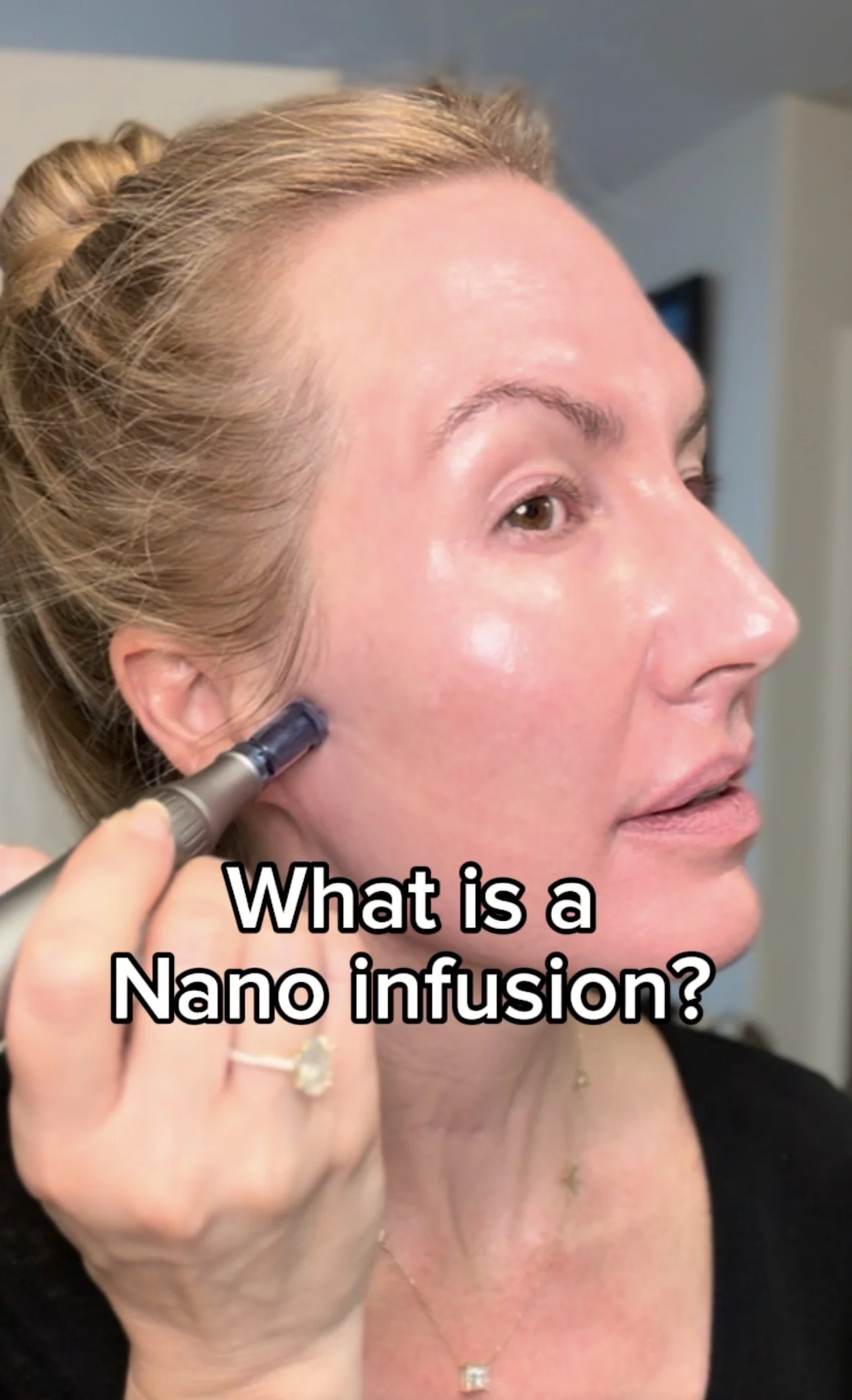 What Is Nano Infusion? My Favorite Treatment for a Glass Skin Glow