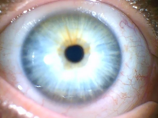 Bio Optic Eye Fiber Reading