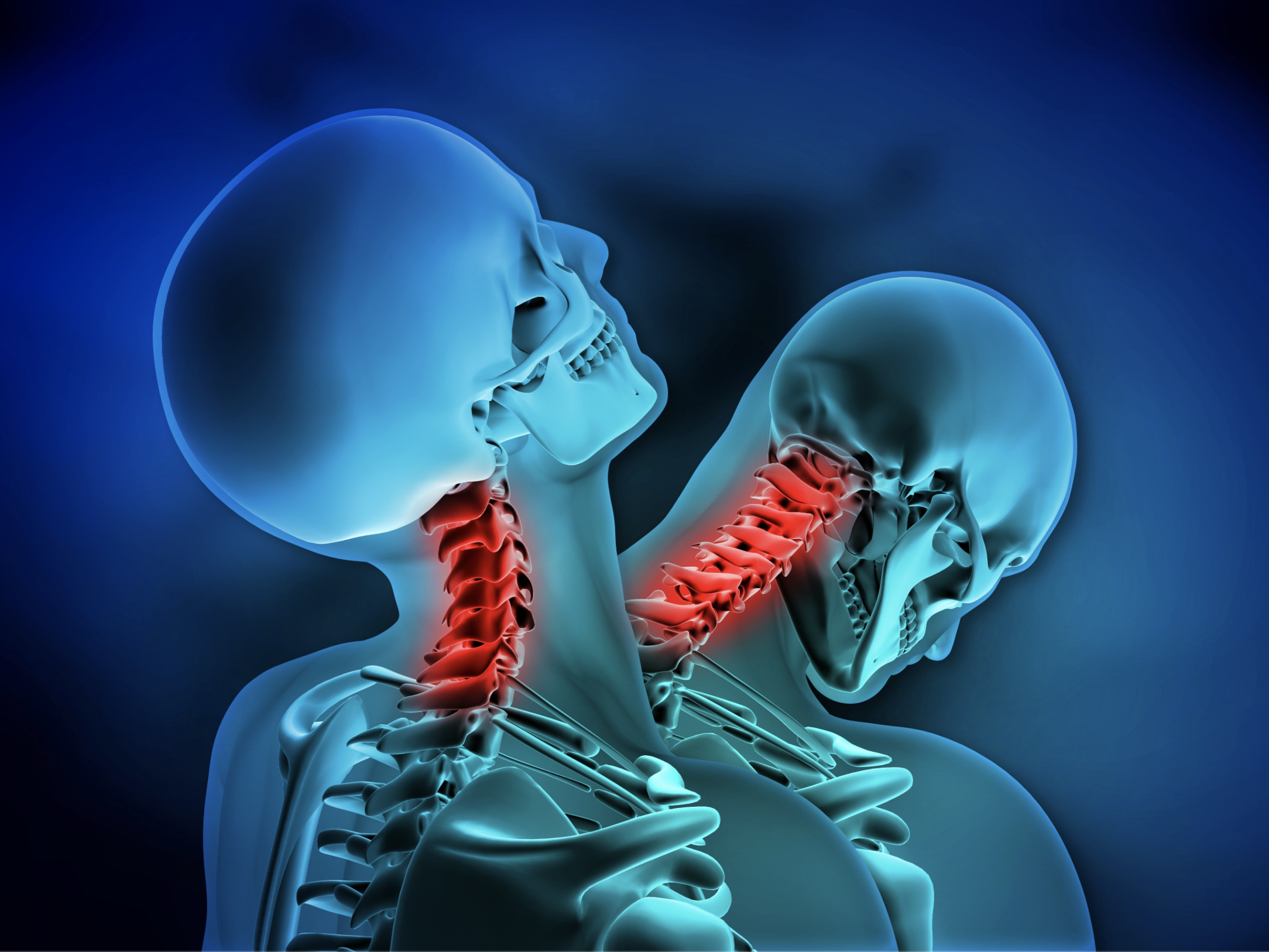A digital illustration of two human skeletons facing each other, with one person's head tilted down and the other looking straight ahead. The skeletons are blue with highlights, and their necks and upper spine areas are highlighted in red, indicating pain or injury.