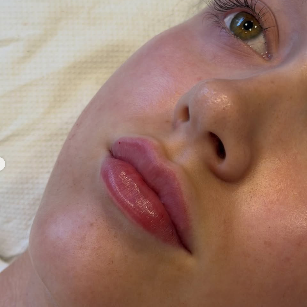 Close-up of a woman's face showing her eye, nose, and lips with glossy lipstick, lying on a textured cream-colored surface.