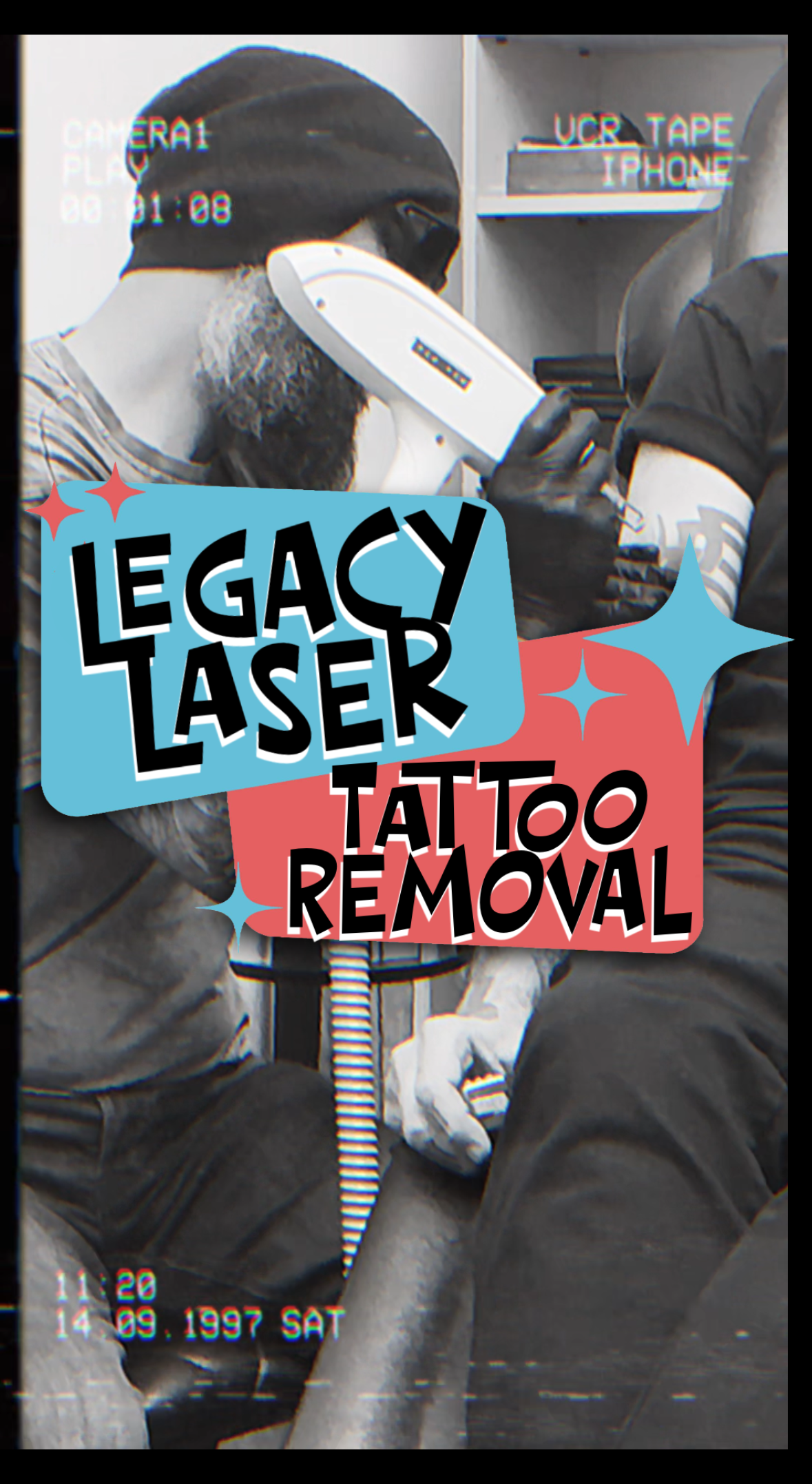 A man with a beard and glasses holding a laser tattoo removal device against another person's arm. The image has a vintage VHS filter overlay. Text overlay advertises a legacy laser tattoo removal service.