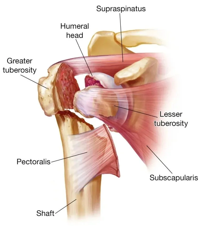 Illustrated shoulder anatomy showing the humeral head and rotator cuff muscles