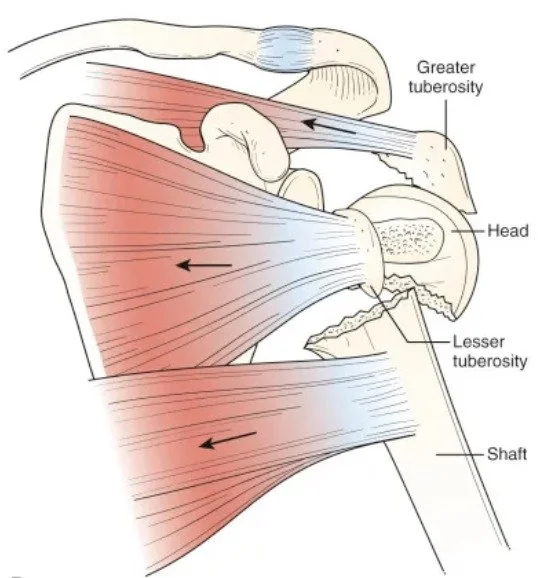 Diagram of the proximal humerus with head, shaft and tuberosities labeled