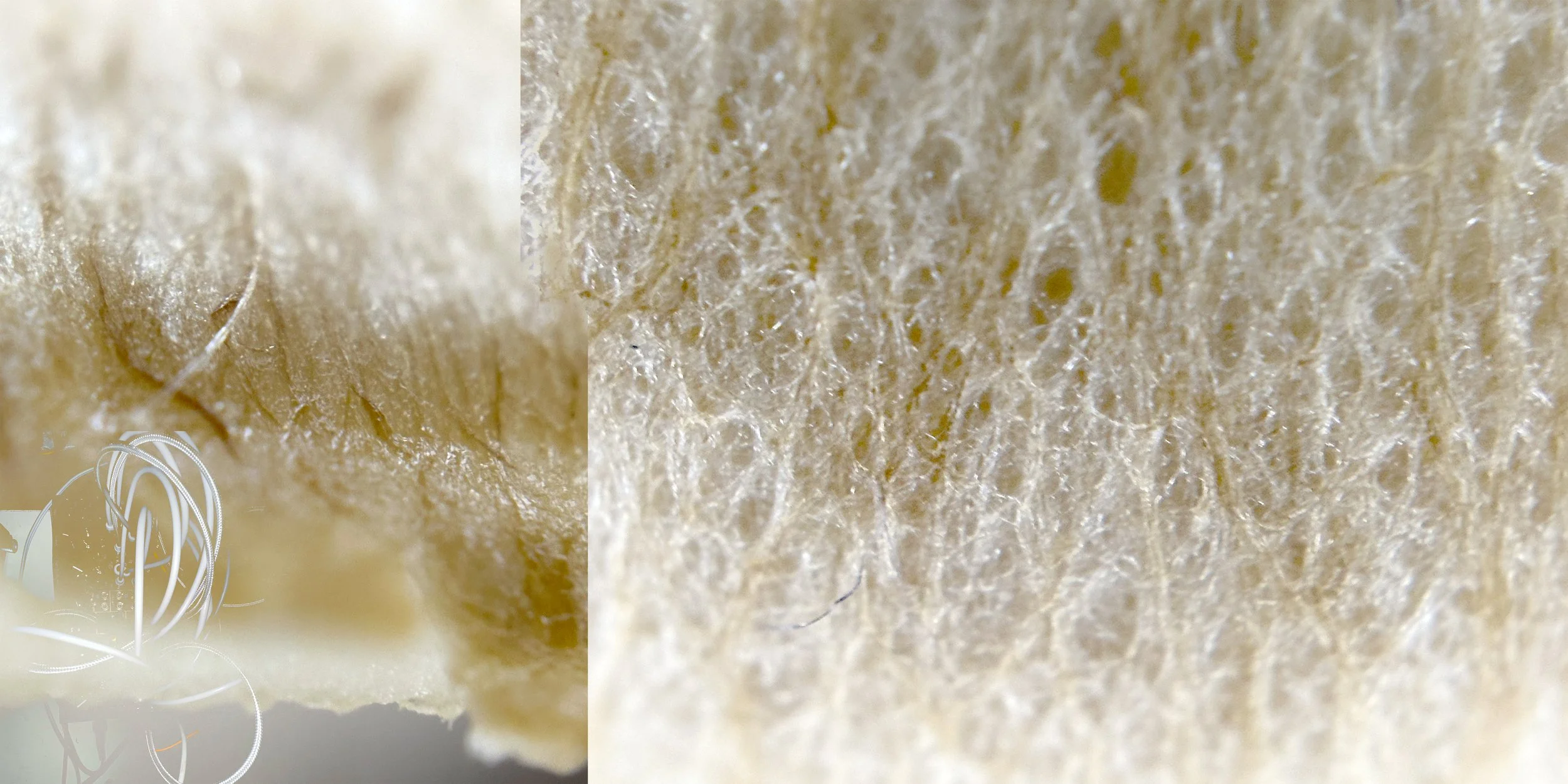 Microscopic image of oyster mushrooms.