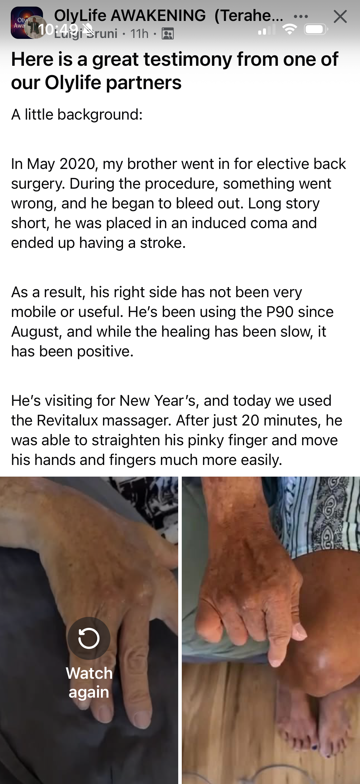 After a stroke, his right side has positive results. He was able to straighten his pinky finger.