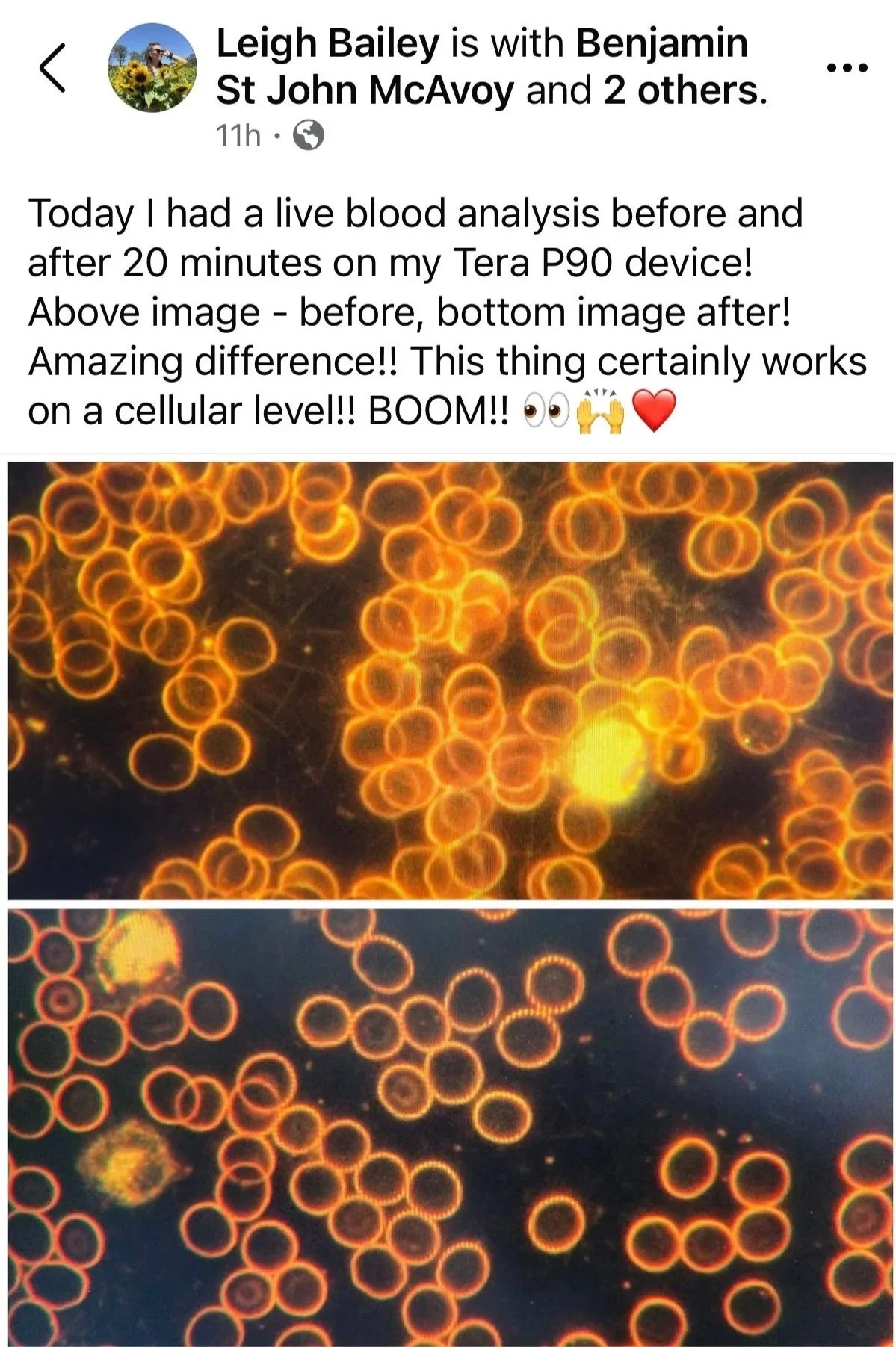 Microscopic image showing numerous glowing orange-red blood cells before and after a blood test.